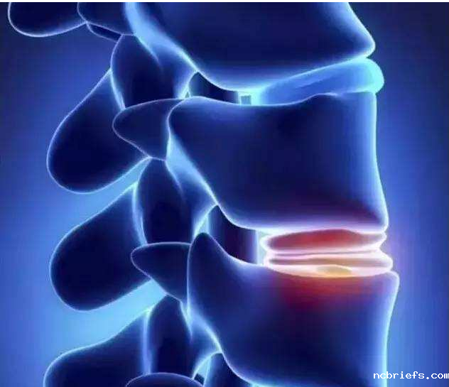超声骨密度检测仪厂家分析检测技术