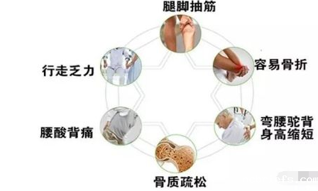 超声骨密度检测仪厂家告诉您骨密度检查怎么做