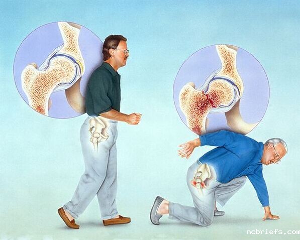 必威app精装版下载官网安装苹果的测量方法有哪些?