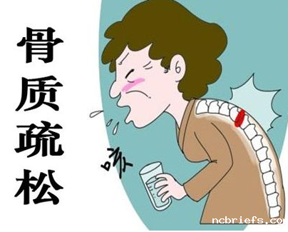 必威app精装版下载官网安装苹果厂家告诉您骨质疏松需要做的检查 必威app精装版下载官网安装苹果厂家告诉您骨质疏松需要做的检查