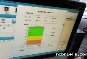 骨密度分析仪生产厂家谈骨密度的检测标准 骨密度分析仪生产厂家谈骨密度的检测标准