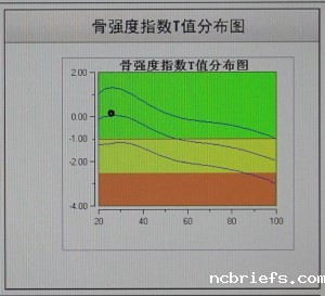 骨密度检测仪测量结果了解一下啦！