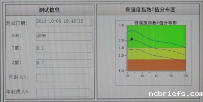 骨密度检测仪测量结果了解一下啦！