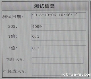 骨密度检测仪测量结果了解一下啦！