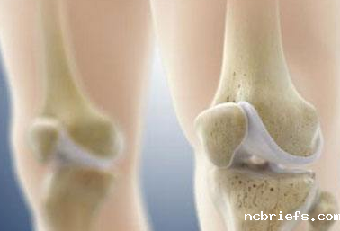 骨密度检测仪厂家国康报道鉴定出一种新的骨密度调节因子