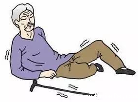 便携式骨密度检测仪分析老年人骨折后的症状有哪些？