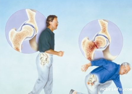 必威app精装版下载官网安装苹果厂家剖析宝宝骨密度低反映的问题