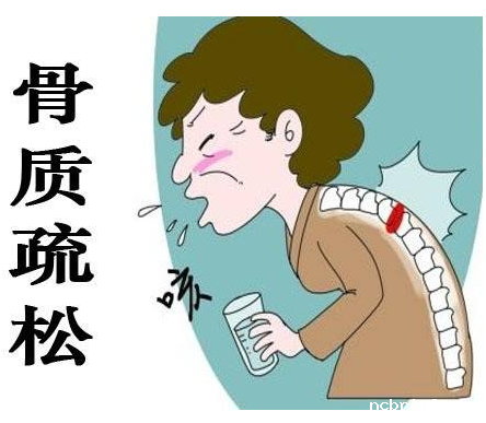 超声骨密度检测仪品牌山东国康