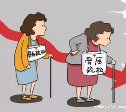 2020【骨密度检测仪】厂家国康解决骨质疏松老问题,「换汤换药」 新方法