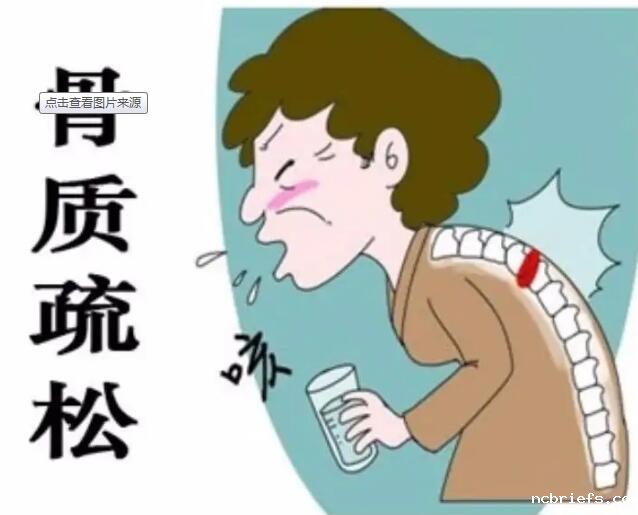 骨密度仪器价格 骨密度仪器价格