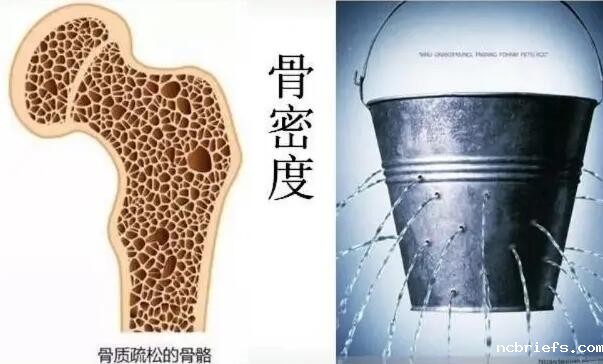 超声波骨密度仪揭示人体骨骼的5个真相！钙流失束手无策？