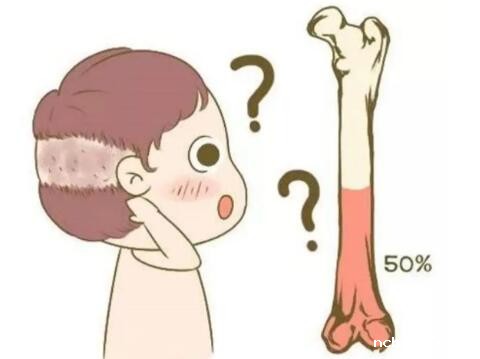 儿童必威app精装版下载官网安装苹果提问宝宝骨密度低，是母乳不好吗？