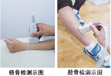 骨密度检测仪 骨密度检测仪