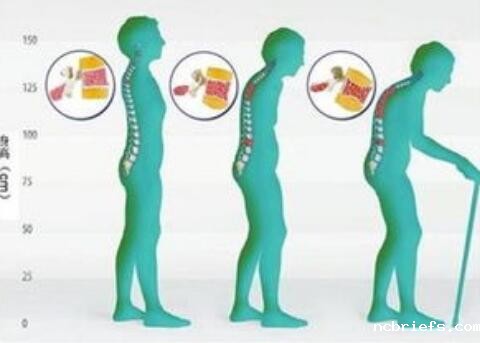 GK-7000型号骨密度检测仪生产厂家国康小编建议怎样添加骨量?