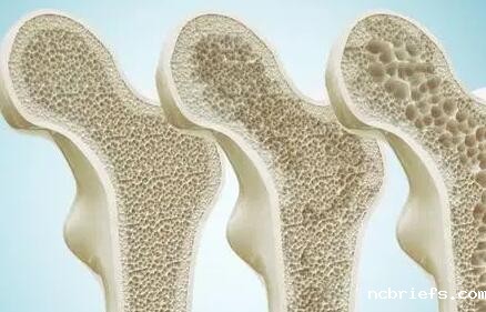 超声波骨密度仪器生产厂家国康主张怎么处理儿童骨密度低的问题!